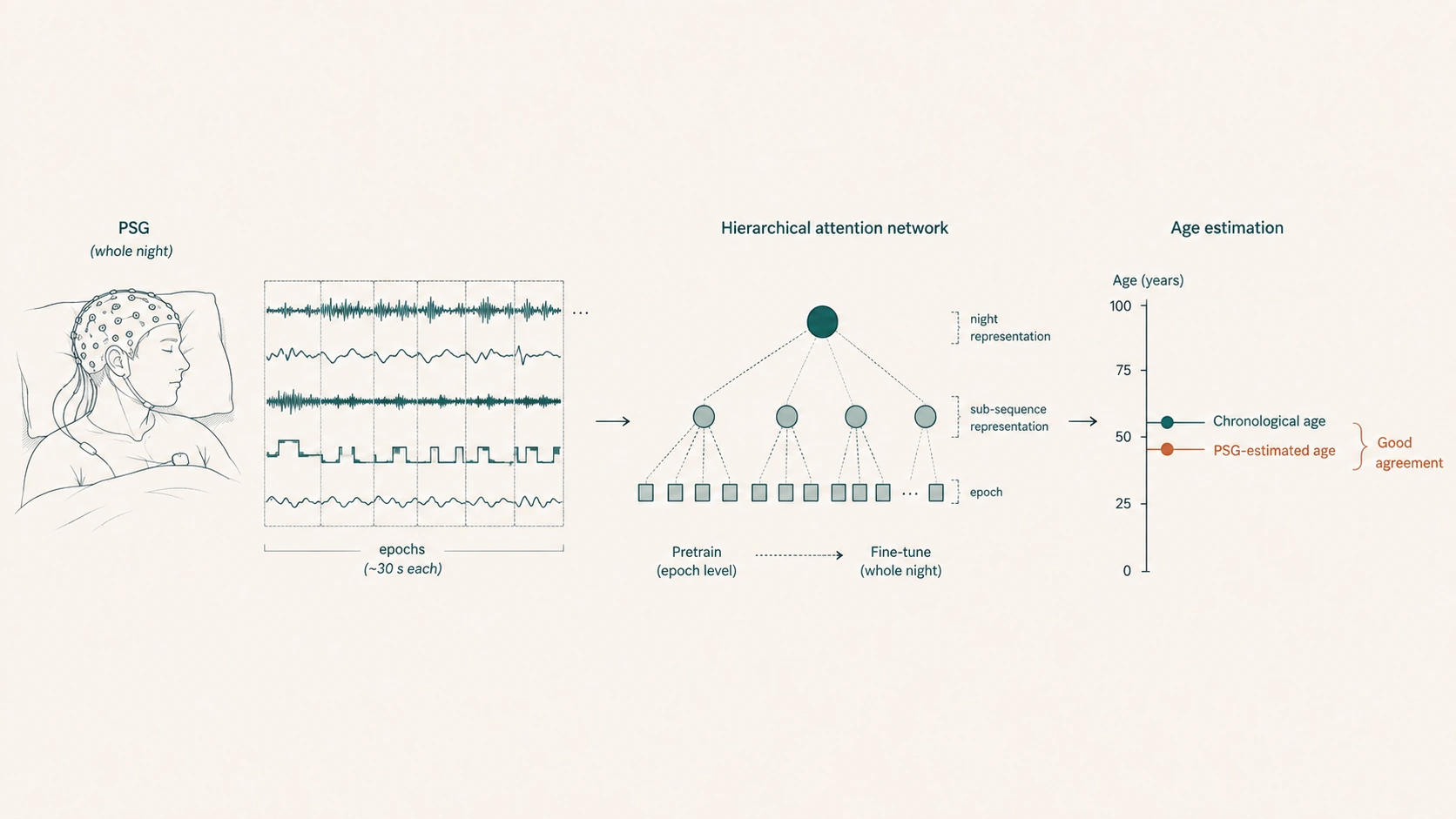Diagram of a hierarchical attention network estimating age from whole-night polysomnography, from epoch-level pretraining to whole-night fine-tuning and age estimation.
