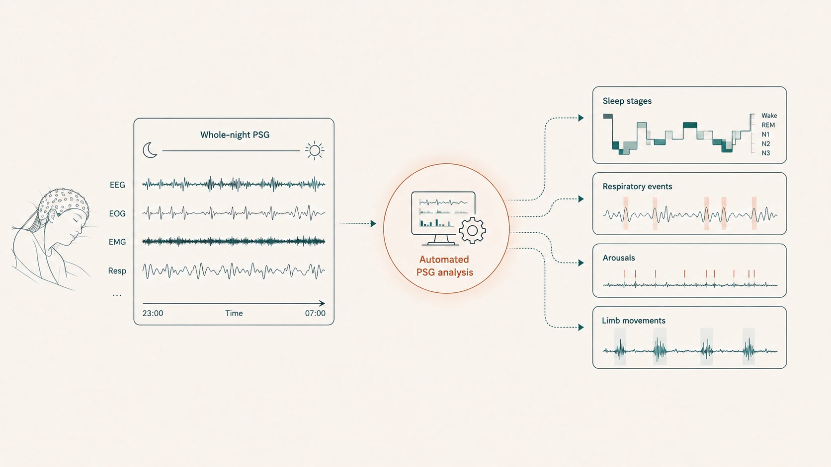 Diagram of automated whole-night polysomnography analysis producing sleep stages, respiratory events, arousals, and limb movements from raw EEG, EOG, EMG, and respiratory signals.