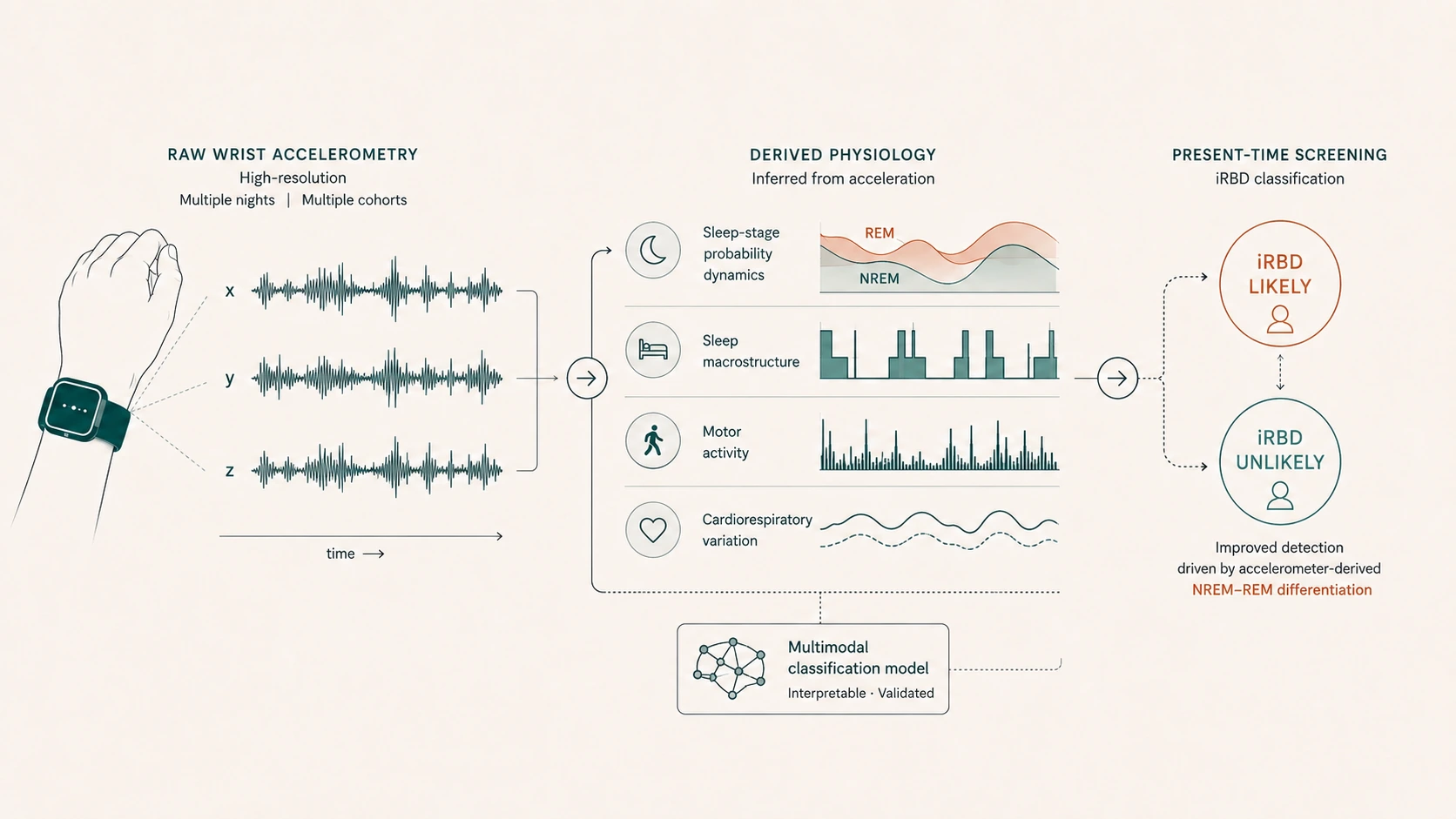 Diagram of physiological signatures derived from wrist accelerometry — sleep-stage dynamics, macrostructure, motor activity, and cardiorespiratory variation — improving present-time iRBD screening.