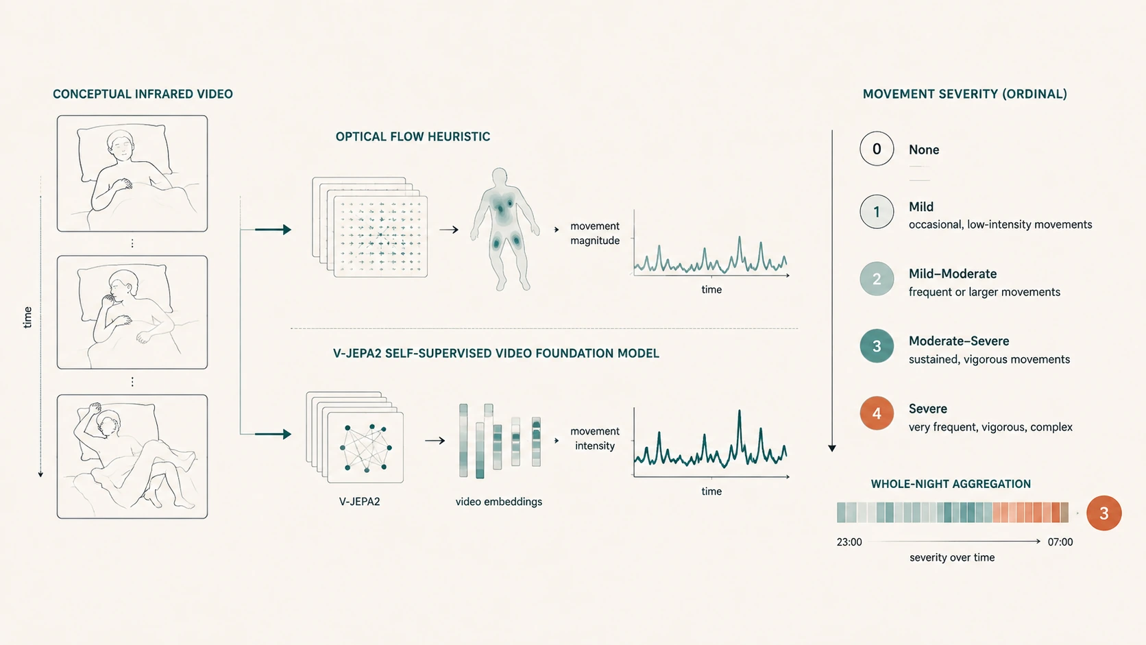Diagram comparing an optical-flow heuristic to the V-JEPA2 video foundation model for rating REM sleep behavior disorder movement severity on a 0-4 ordinal scale, aggregated across a whole night.