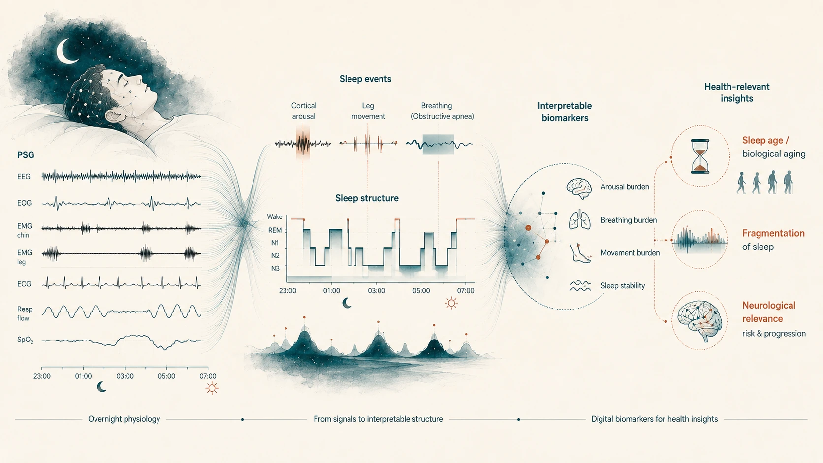 Illustration of a sleeping figure connected to a polysomnography signal panel (EEG, EOG, EMG, ECG, respiration, SpO2), which resolves into detected sleep events and a night-long hypnogram, then into interpretable biomarkers of arousal, breathing, movement, and stability that feed sleep-age, fragmentation, and neurological-risk insights.